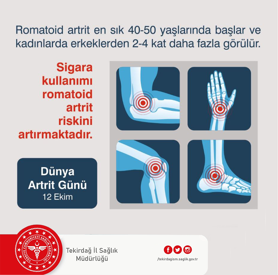 DÜNYA ARTRİT GÜNÜ